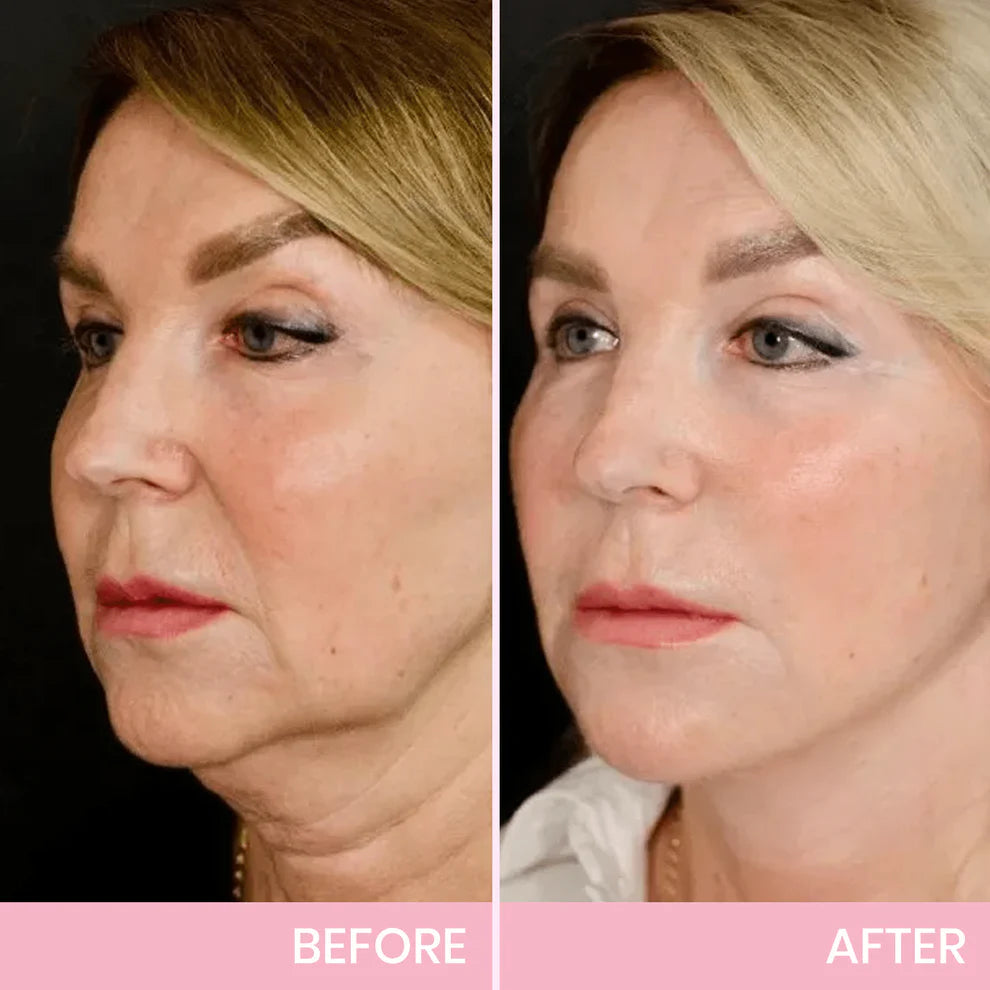 OUHOE V-Face Lifting Invisible Adhesive Tape
