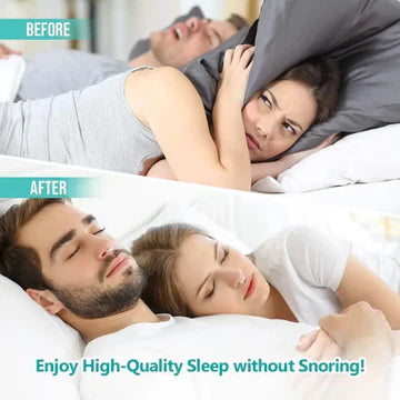 ANTI SNORING DEVICES