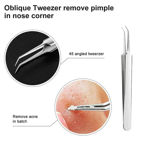 Professional Facial Blackhead Remover Tweezers (3Pcs+Box)