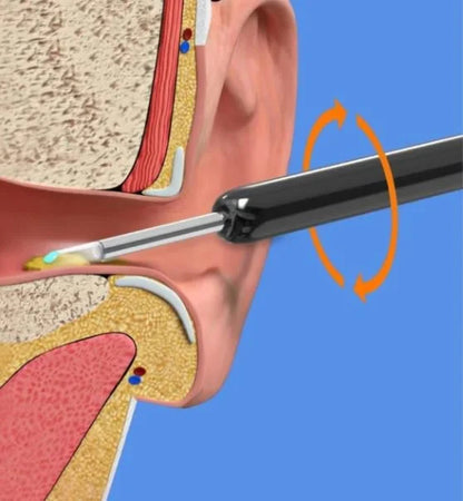 Clean Earwax-Wi-Fi Visible Wax Removal Spoon, USB 1296P HD Load Otoscope (60% OFF TODAY!)