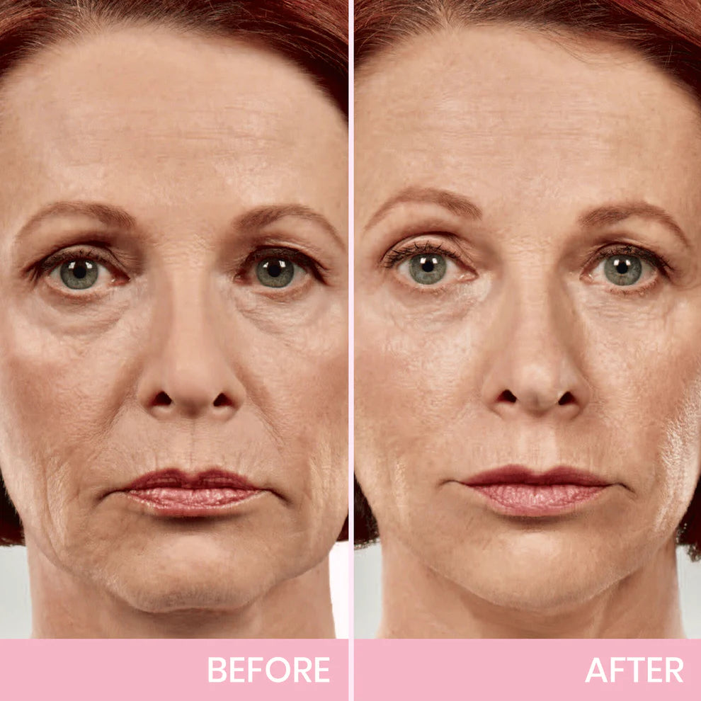 OUHOE V-Face Lifting Invisible Adhesive Tape