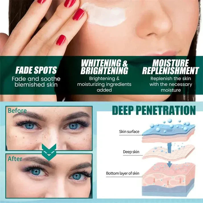 Dark Spot Corrector Skin Whitening Cream