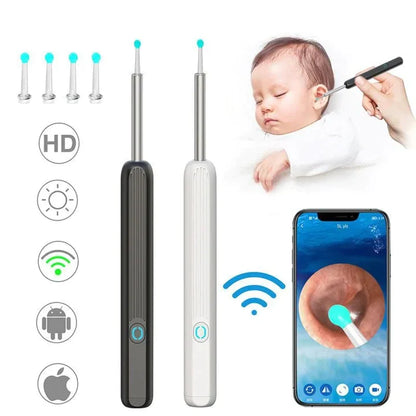 Clean Earwax-Wi-Fi Visible Wax Removal Spoon, USB 1296P HD Load Otoscope (60% OFF TODAY!)