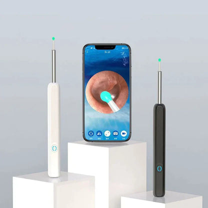 Clean Earwax-Wi-Fi Visible Wax Removal Spoon, USB 1296P HD Load Otoscope (60% OFF TODAY!)