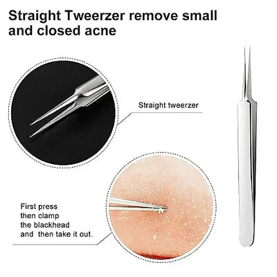 Professional Facial Blackhead Remover Tweezers (3Pcs+Box)